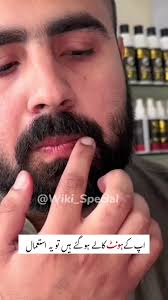 Wiki Special  Lips Balm